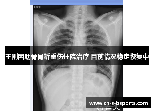 王刚因肋骨骨折重伤住院治疗 目前情况稳定恢复中